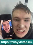 Фото пациента до и после посещения медицинского центра Жуйкан